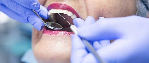 Best Urgent Care for Lost Fillings or Crowns in Birch Run, MI